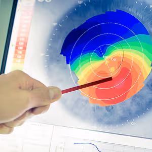 A person examining a detailed color-coded eye scan on a monitor screen