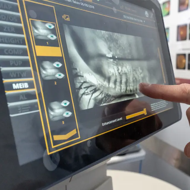 A person is pointing at a dental x-ray image on a monitor screen with a finger, the monitor is displaying a medical image of teeth and has a yellow border.