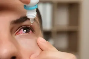 A person is administering eye drops to their eye in a clinical setting.