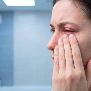 A woman with a red eye is in pain. She is holding her face with her hand.