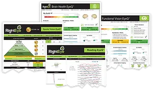 A collage of various RightEye software interface screens, each displaying different types of eye tests and their results, with a focus on brain health and vision assessment.