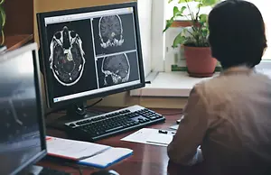 A person is looking at a computer monitor showing an MRI scan of the brain
