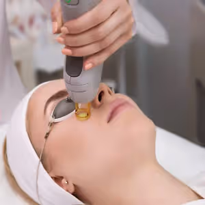 Woman undergoing laser treatment for wrinkles on her face.