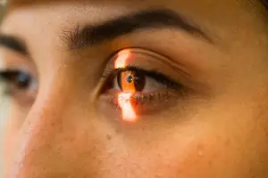 Close up of a woman's eye with a yellow light shining in the pupil