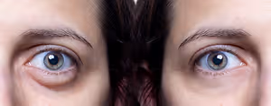 Close-up of two women's eyes with brown irises and red eyelids.