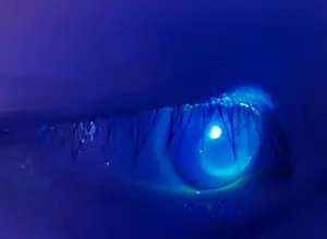A close-up of a human eye with blue iris and eyelashes illuminated by a light