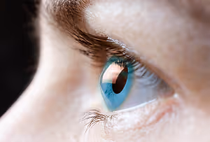 keratoconus eyes flipped