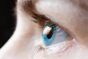 keratoconus eyes flipped