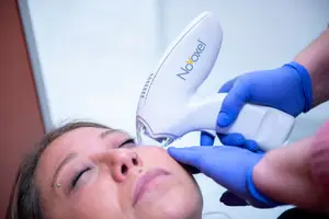 A person is using a Novoxel device on a woman's face, while the woman is sitting and closing her eyes.