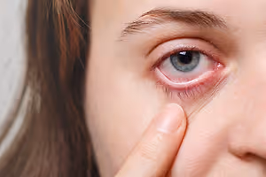 A close-up of a woman's face with her finger on her eye, possibly trying to remove something from her eye.