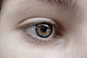 A close-up of a young person's eye with blue and green irises.