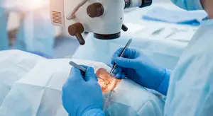 Doctor in blue scrubs and blue gloves performing eye surgery with surgical tools and a microscope