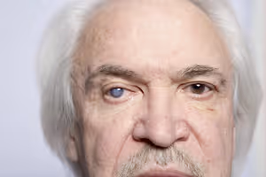 Closeup of an older man with one blue and one brown eye looking down
