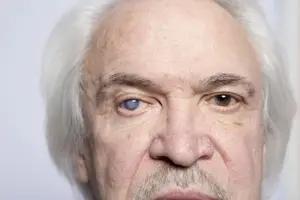 Closeup of an older man with one blue and one brown eye looking down