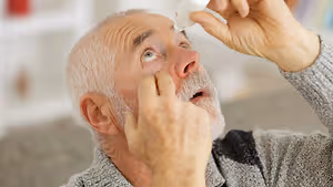 An old man with a beard is looking upward and applying eye drops into his eye.