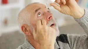 An old man with a beard is looking upward and applying eye drops into his eye.