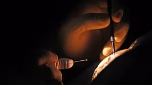 A close-up of a person's hand holding a needle and performing an eye procedure.