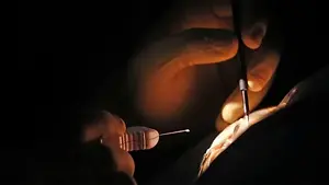 A close-up of a person's hand holding a needle and performing an eye procedure.