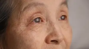 A close-up of an elderly woman's eyes with a grayish tint and wrinkles around them.