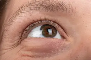 Closeup of a woman's eye with brown iris and eyelashes, possibly in a hospital setting