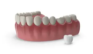 A 3D model of a dental arch with teeth on a white background