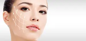 A woman's face with cosmetic lines drawn on it for facial treatment