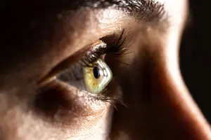 A close-up of a man's eye with a greenish iris and a teardrop-shaped pupil