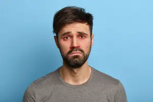 Man with a red eye and a serious expression