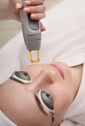 A woman wearing protective glasses lying on her back in a salon with a person holding a laser device over her face.