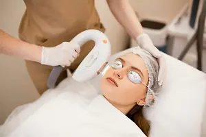 A woman is receiving laser treatment for her face while lying on a bed, with a person wearing gloves and a brown coat nearby, holding a white laser machine.