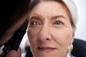 A woman with yellow eyes and wrinkles on her face being examined by a doctor with a black device