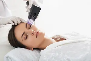 A woman lying down on a bed with a white robe covering her body, receiving a laser treatment on her face by a person in a white robe and gloves, using a laser machine with a purple tip, in a salon with white walls and a towel on the bed.