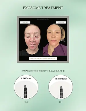Exosome treatment graphic showing two post-treatment facial photos and AM D|TOX Serum and PM RE|PAIR Serum skincare products