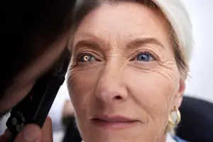 A woman with yellow eyes has her eyes checked by a person with a remote control in their hand.