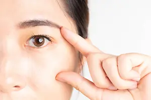 Woman gently pulling the skin beside her eye to demonstrate eyelid area