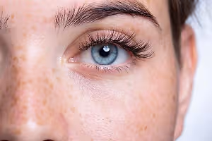 A close-up view of a woman's face with blue eyes, freckles, and a white background