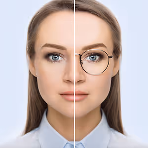 woman before and after lasik