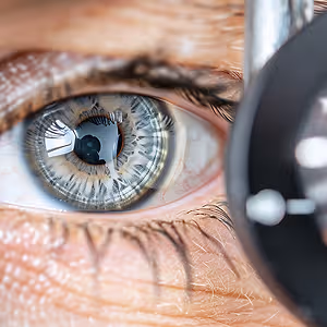 eye close up
