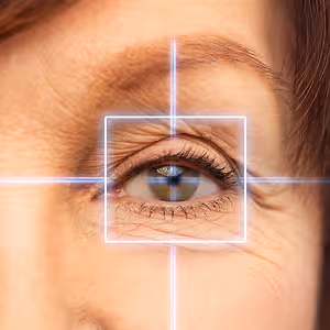 lasik close up