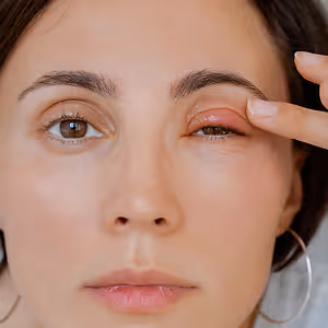 woman with pink eye