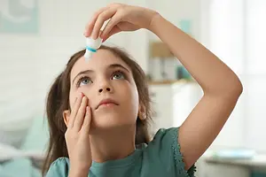 A girl applying eye drops while looking at the camera