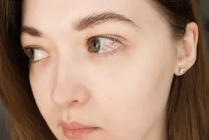 Close up of a woman's eye with a red vein in the sclera.