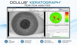 An advertisement for Oculus Keratograph tear film analysis system, showcasing a screen display with patient information and eye analysis results.