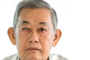 Image of an elderly man with gray hair and wrinkled skin staring at the camera with a slightly frowning face